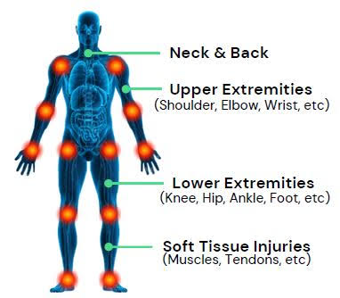 Anatomical diagram highlighting common personal-injury areas: neck and back, upper extremities, lower extremities, and soft tissue